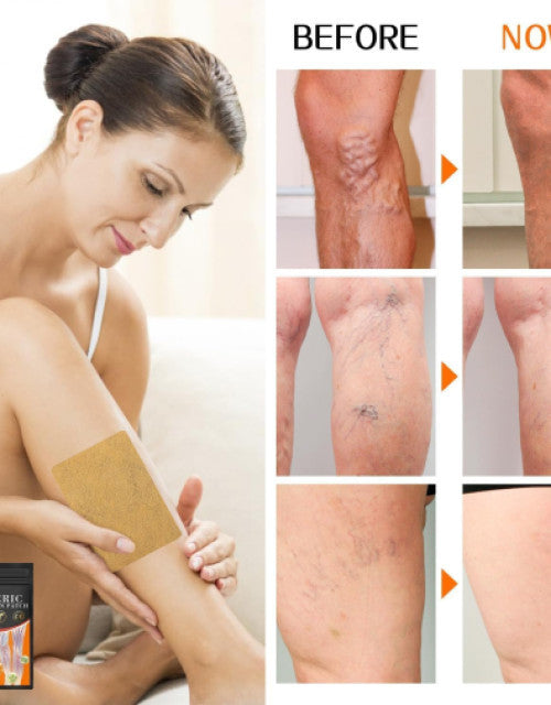 Turmeric Varicos Vein Patch Pack of 1 ( 10 Psc )
